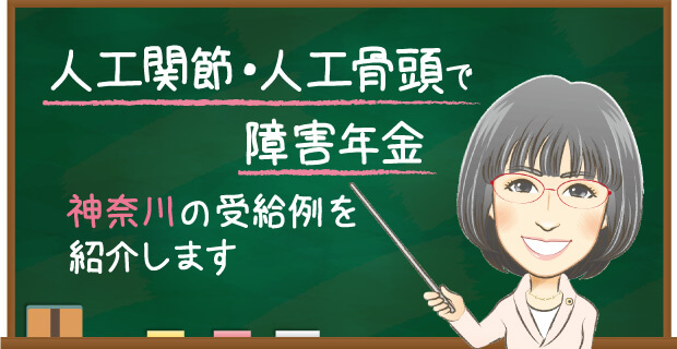 人工関節・人工骨頭で障害年金　神奈川の受給例を紹介します